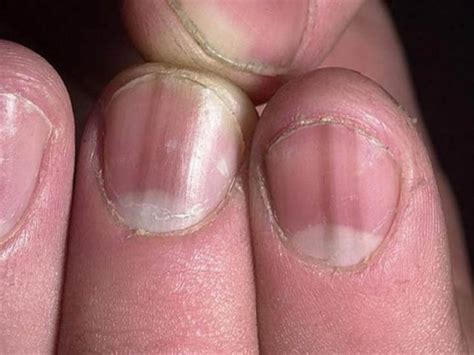 3 Razones por las cuales tus uñas son naturalmente oscuras